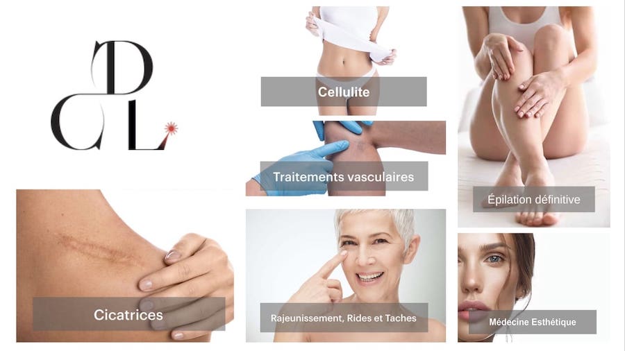 dermacare laser